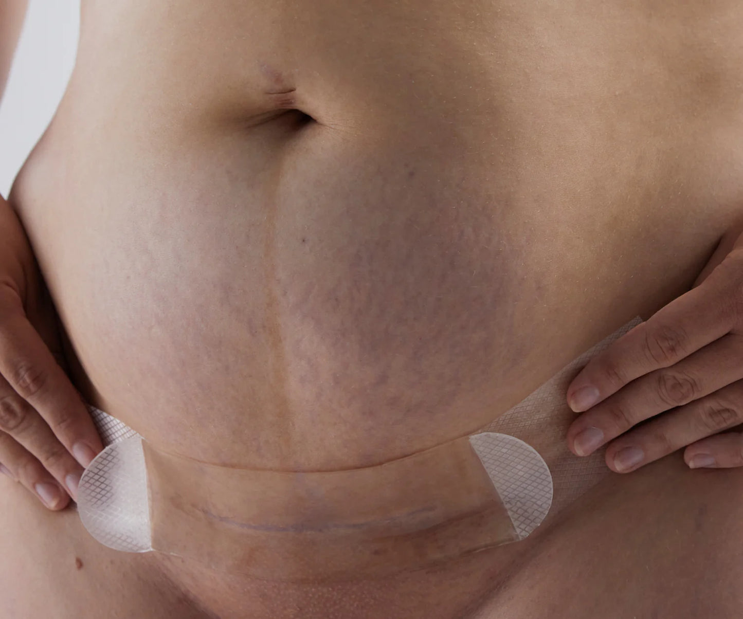 Bare Mum Silicone Gel Scar Strips Washable & Reusable