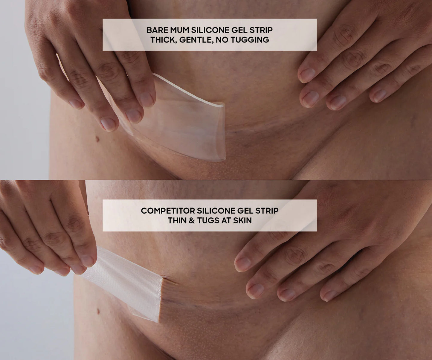 Bare Mum Silicone Gel Scar Strips Washable & Reusable
