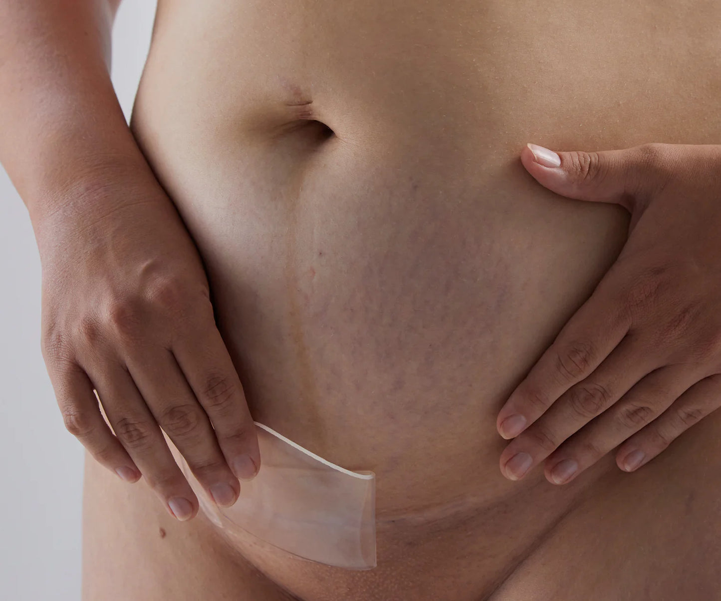 Bare Mum Silicone Gel Scar Strips Washable & Reusable